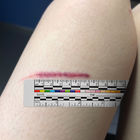 Self Ahesive Wound Treatment Medical Tape Measure Ruler For Nurses Documentation